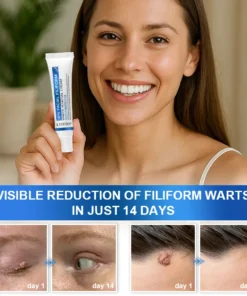 LYYETO® HPV Facial Filiform Warts Removal Cream
