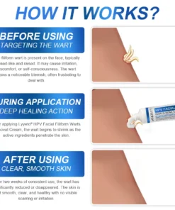 LYYETO® HPV Facial Filiform Warts Removal Cream