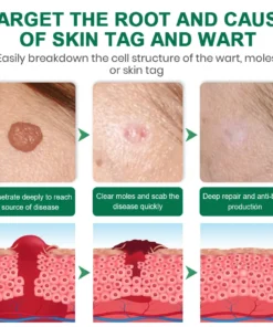 Lyyeto® Herdle Shot Spot & Mole Correct Serum