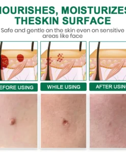 Lyyeto® Herdle Shot Spot & Mole Correct Serum