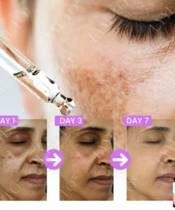 Lyyeto® MelantraX Advanced Brightening Essence ACE