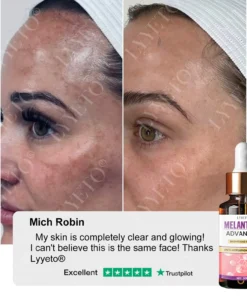 Lyyeto® MelantraX Advanced Brightening Essence ACE