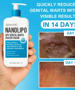 LYYETO® NANOLIPO HPV GENITAL WARTS ERASER CREAM