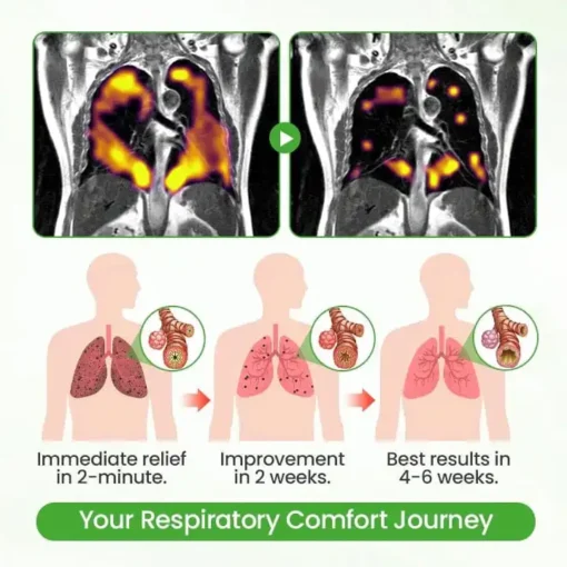 Lyyeto® HerbaAir Mullein Lung Purifier