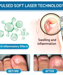 Lyyeto® OnyxiGuard Fungal Repair Herbal Spray