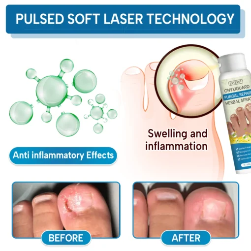 Lyyeto® OnyxiGuard Fungal Repair Herbal Spray