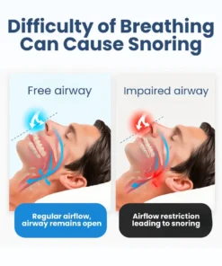 Lyyeto® Snoreless Nasal Breather ACE