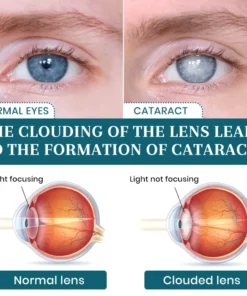 Lyyeto® OptiFusion Nano Eye Drops Serum