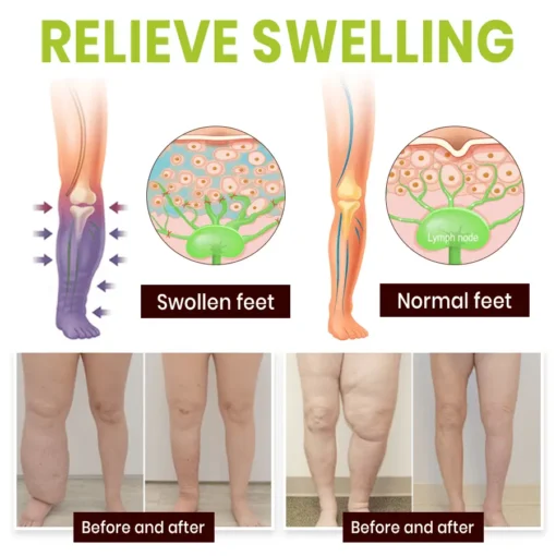 Lyyeto® Professional Leg Circulation Cream