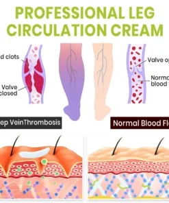 Lyyeto® Professional Leg Circulation Cream