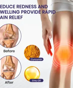 Lyyeto® Turmeric & Emu Oil Arthritis Soothing Pain Relief Massage